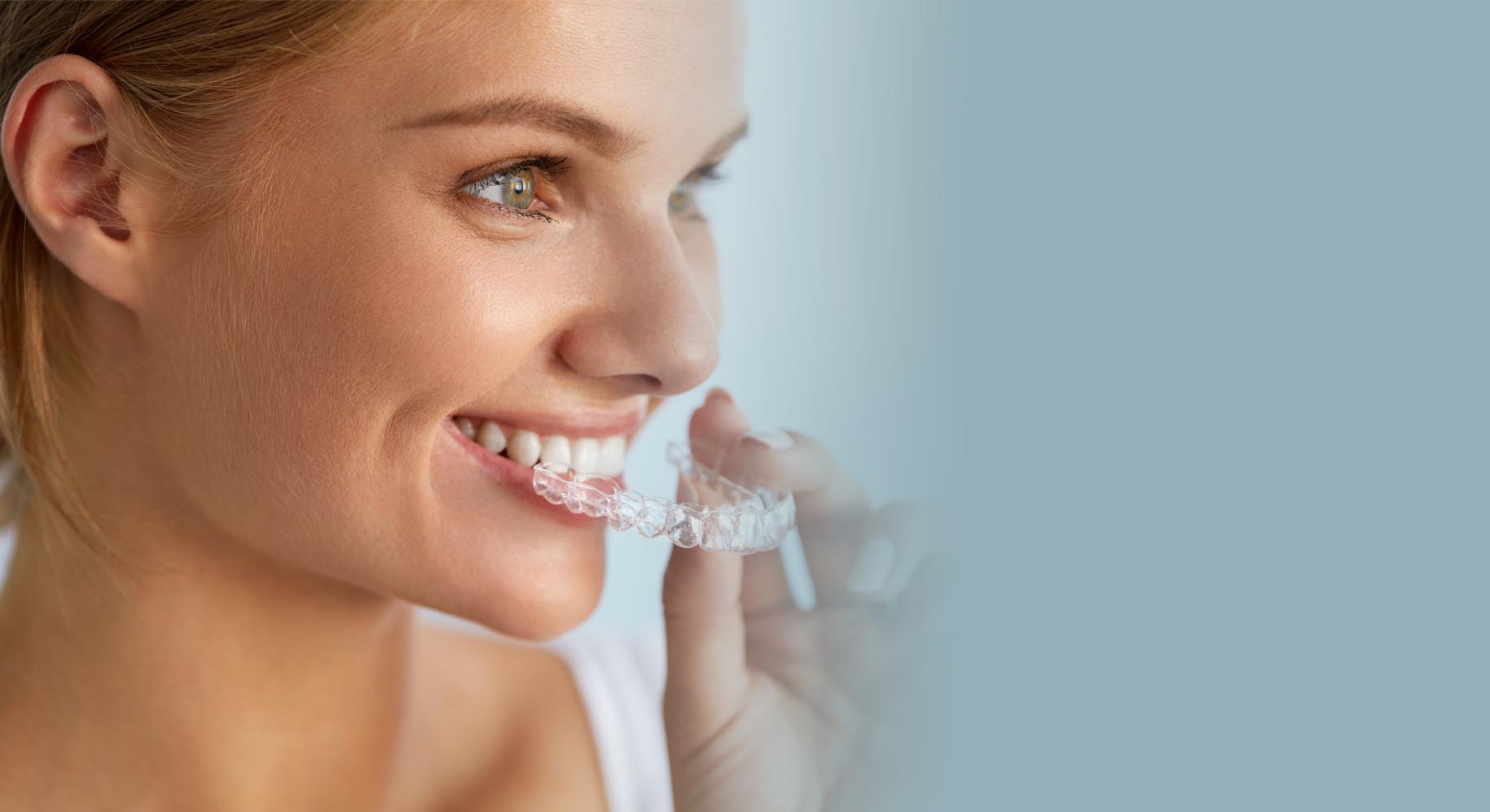 Spring Invisalign Special $3995!