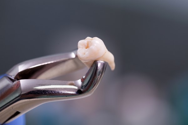 What Can Happen If Wisdom Teeth Are Not Removed?